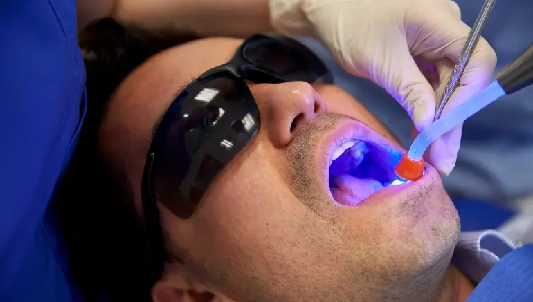 Dental Filling in Dallas